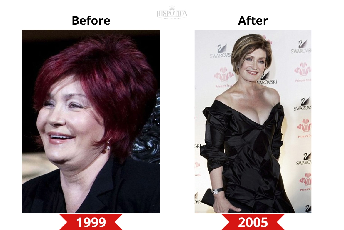 Sharon Osbourne before and after weight loss