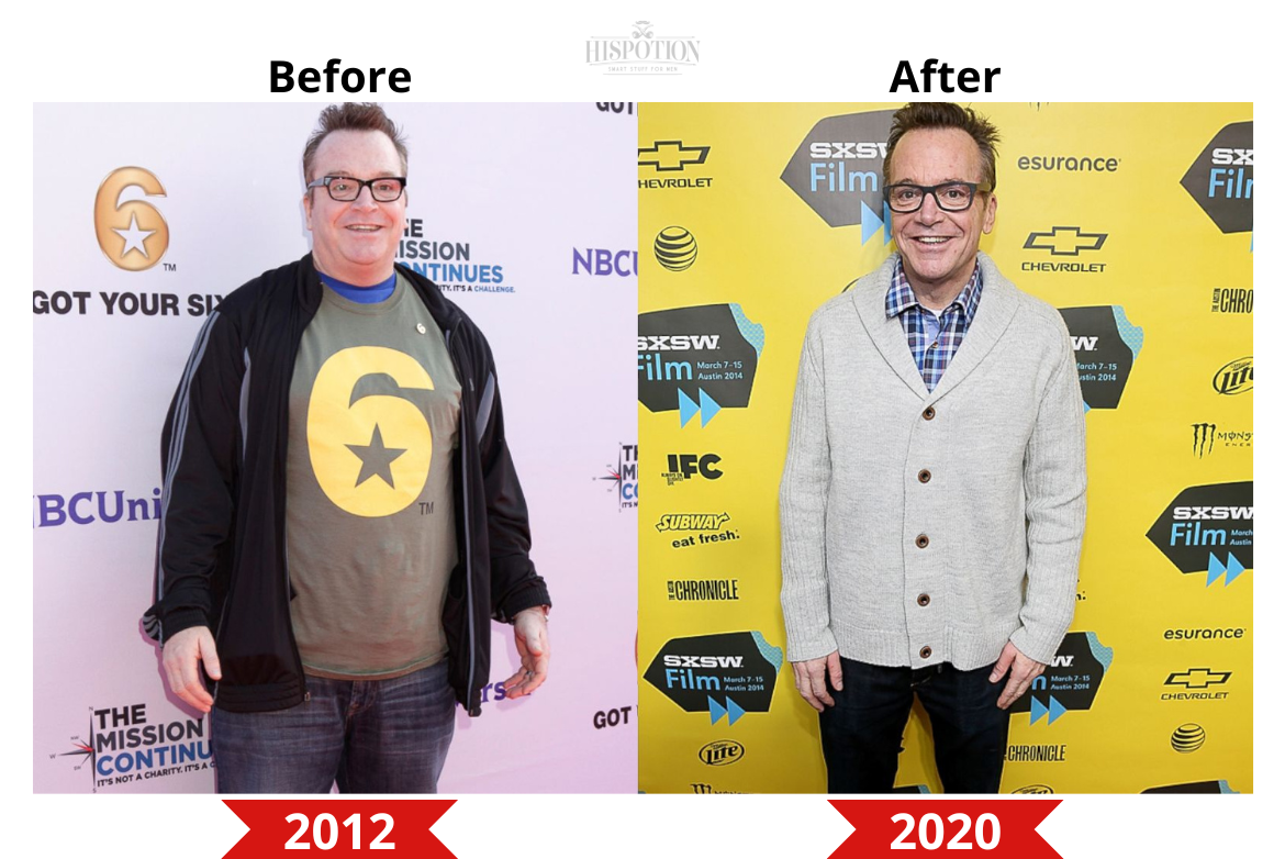 Tom Arnold before and after weight loss