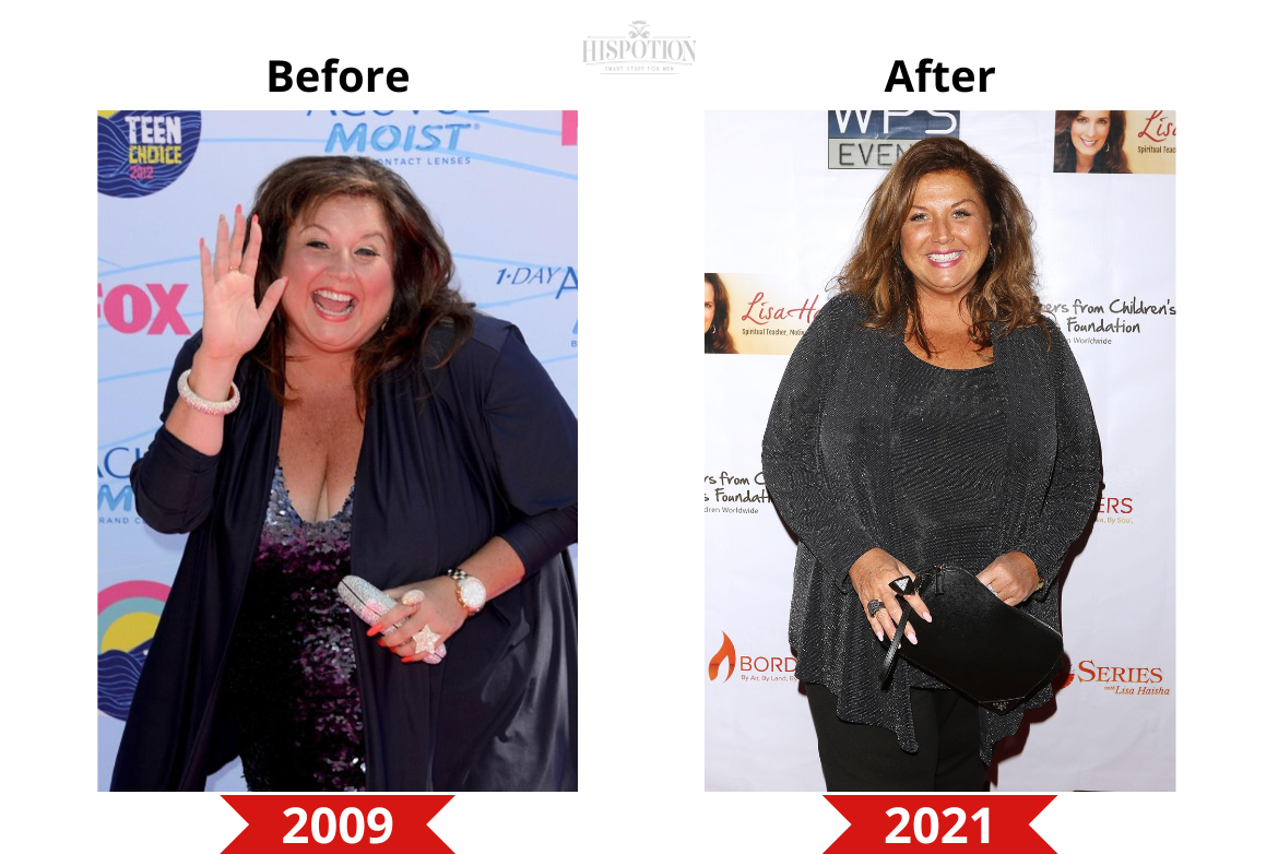 Abby Lee Miller Before and After Weight Loss